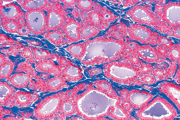 MP: Série pour écoles secondaires no. IV. Organes des hormones et fonctions hormonales