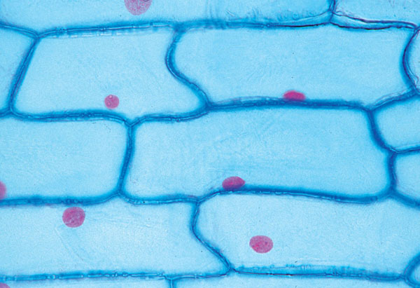 MP: La cellule végétale