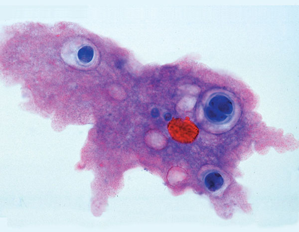 MP: Zoologie, série courte. Protozoaires