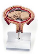 Modèle  : utérus avec fœtus, 4e à 5e mois