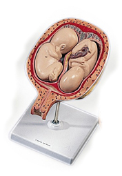 Modèle : utérus avec fœtus amovibles (jumeaux), 5e mois, position normale