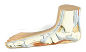 Modèle : pied plat (pes planus)