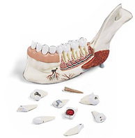 Modèle : hémi-mandibule avec 8 dents cariées, en 19 parties