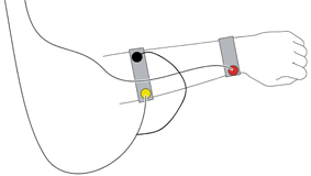 Electromyogramme (EMG)